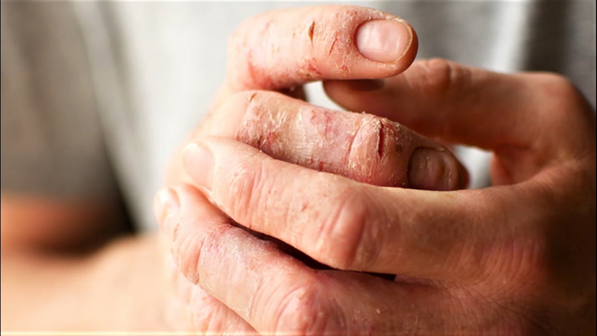 Coronavirus and your skin: tips for taking care of your hands |  