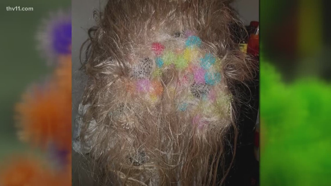 Mom warns parents after child gets 150 'Bunchems' stuck in hair - Good  Morning America