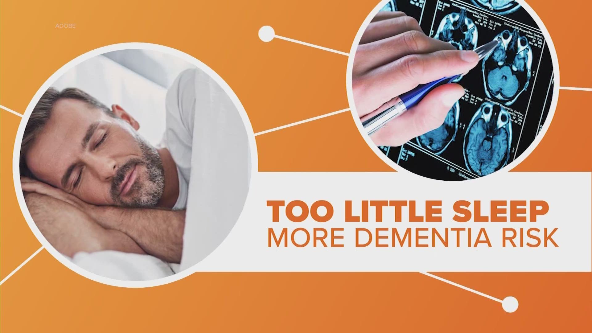 New research suggests getting too little sleep can increase your risk of dementia. Let’s connect the dots.