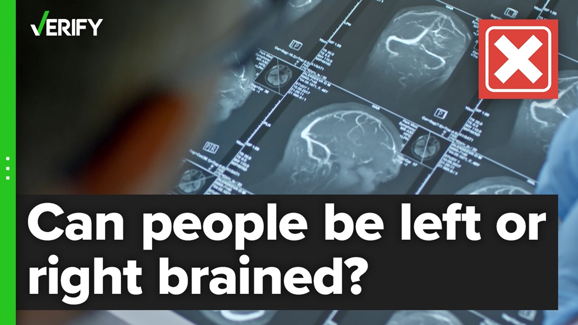 Are people either left-brained or right-brained? The VERIFY team confirms this is false.