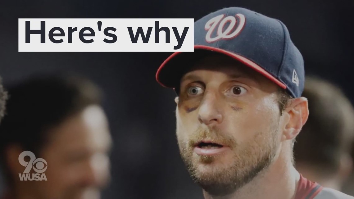 max scherzer eyes max scherzer eyes