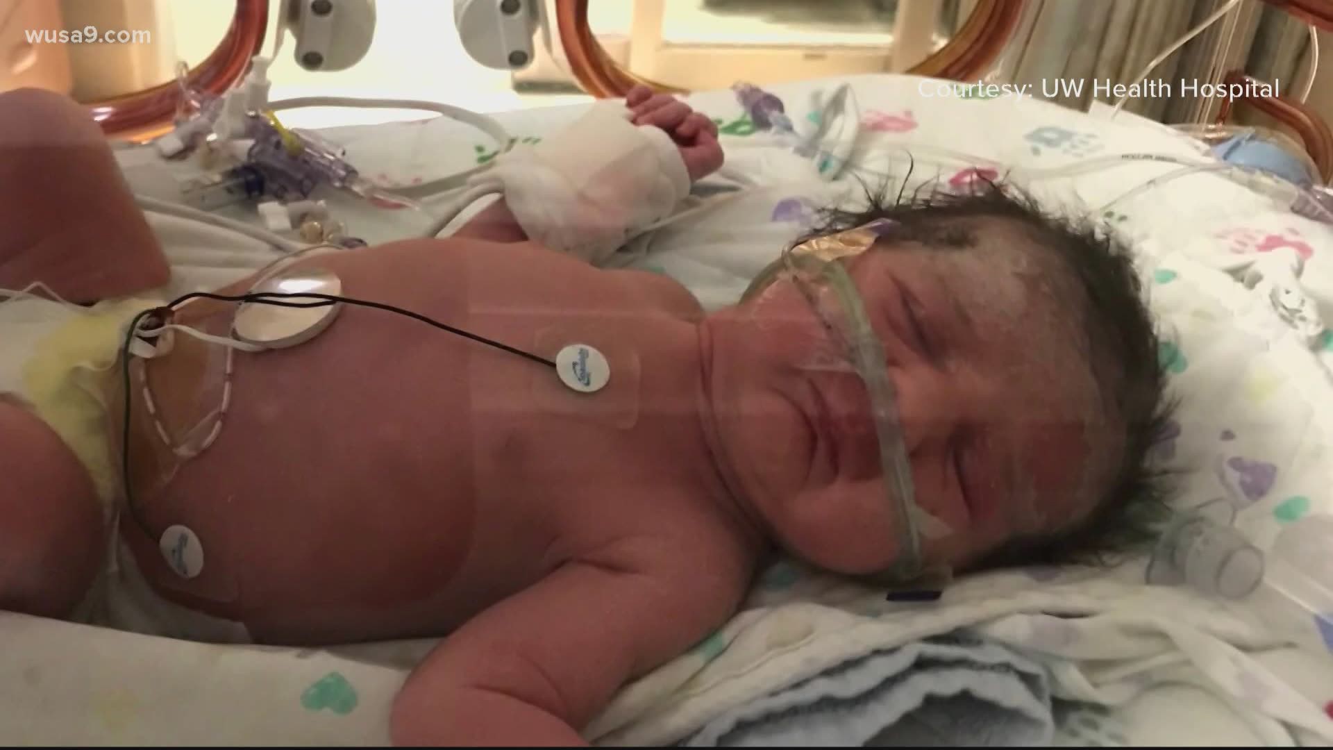The mom was in a medically induced coma when her daughter was born.