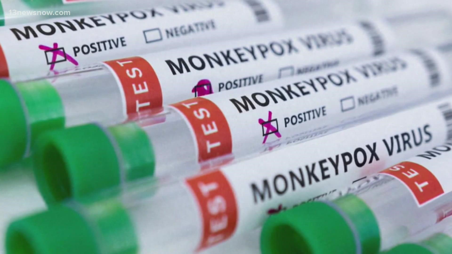 Virginia now has 122 cases of monkeypox. Nationwide, more than 7,500 people have tested positive.
