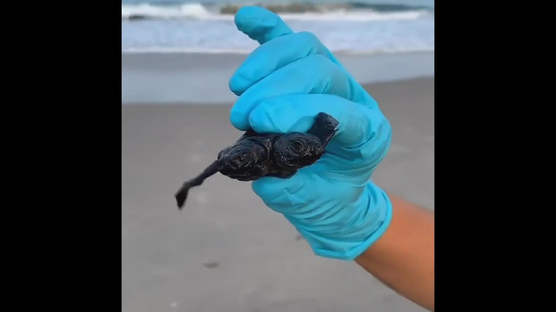Biologists with the National Park Service found at two-headed sea turtle on Cape Hatteras National Seashore on the Outer Banks of North Carolina.
