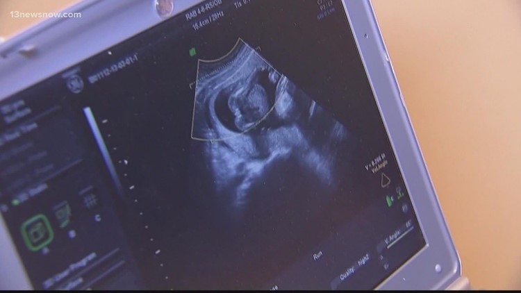 VERIFY: Looking into controversial abortion claims