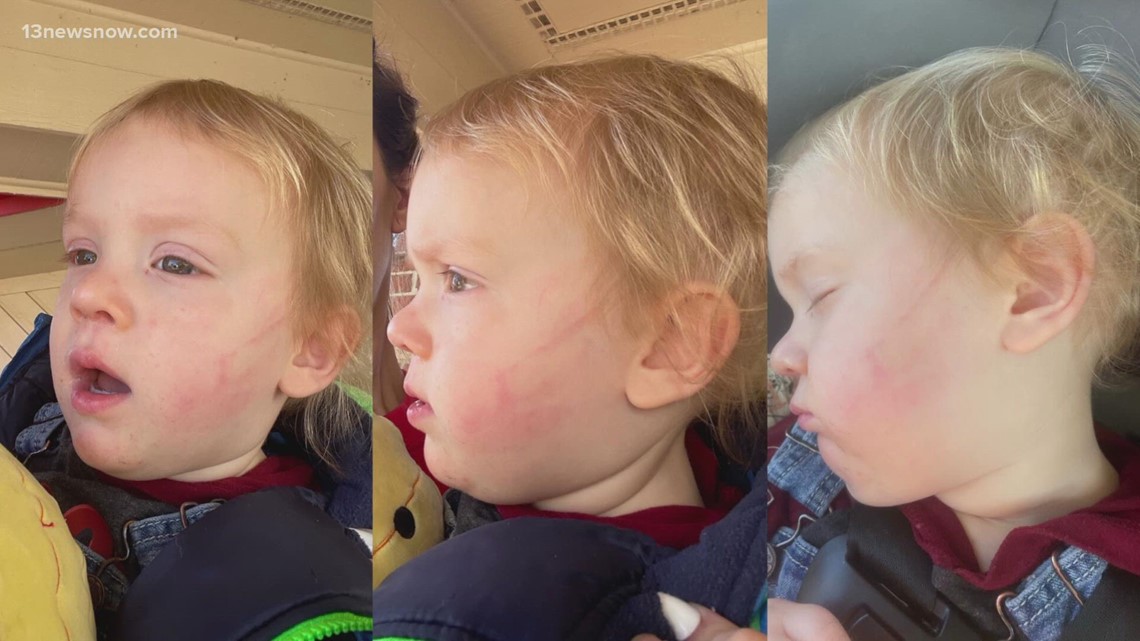 parents-claim-child-slapped-at-daycare-13newsnow