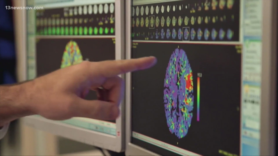 'Time is brain': Sentara Health urges Hampton Roads residents to act fast on stroke symptoms