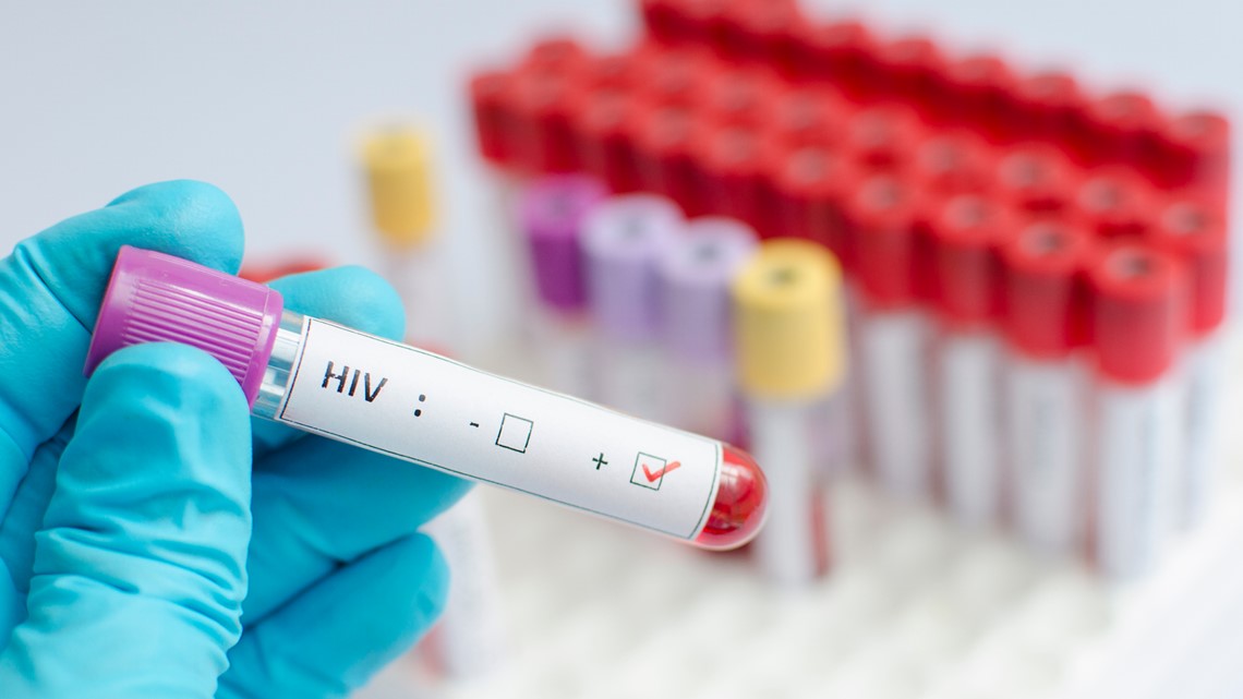 Free HIV testing in Virginia Beach - Vimarsana News