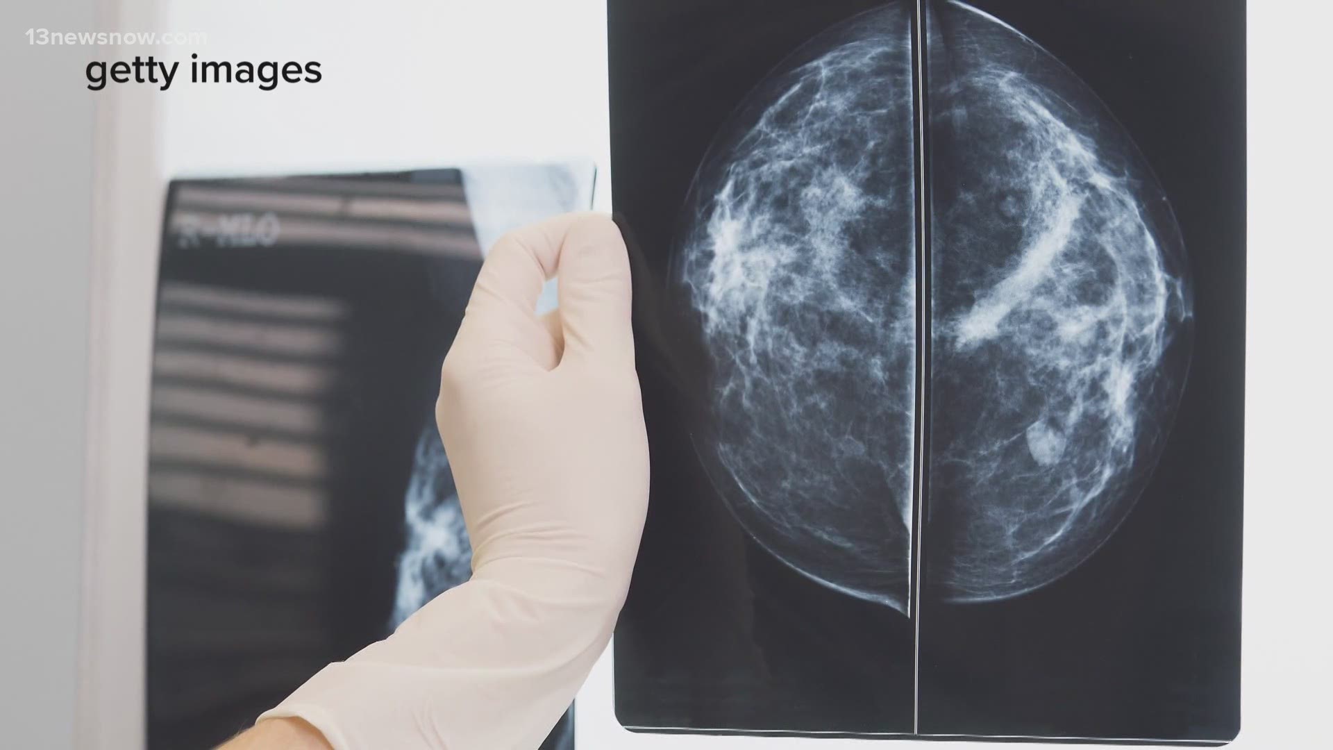 Researchers at the University of Virginia have identified a gene that spreads “triple-negative” breast cancer to other parts of the body.
