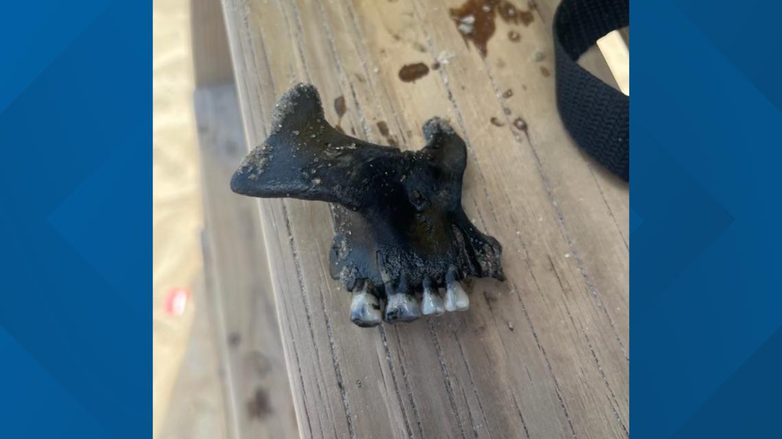 Part of human jawbone washes up on OBX beach - Vimarsana News