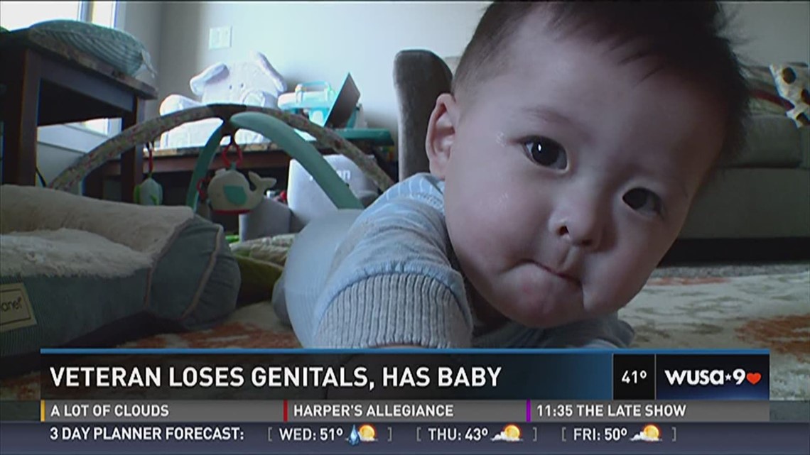 Veteran loses genitals, has baby | 13newsnow.com
