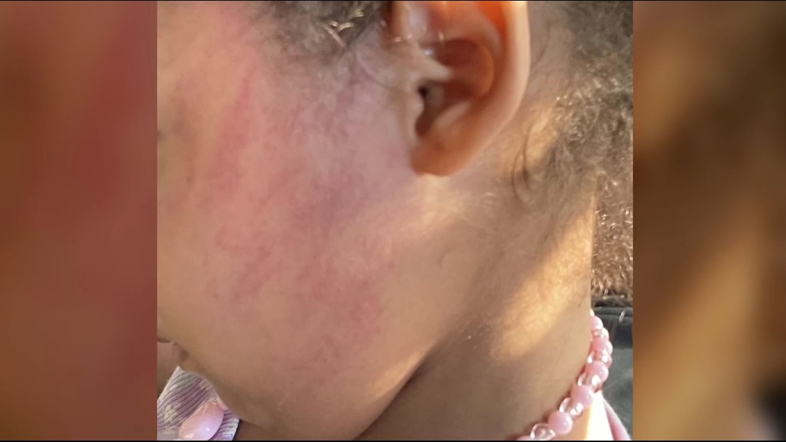 Daycare owner charged after mother says her 3-year-old got hurt - Vimarsana News