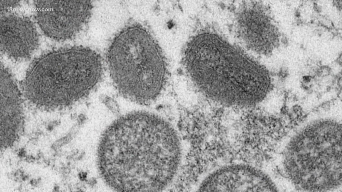 CDC to rename monkeypox due to concerns of racist, stigmatizing language