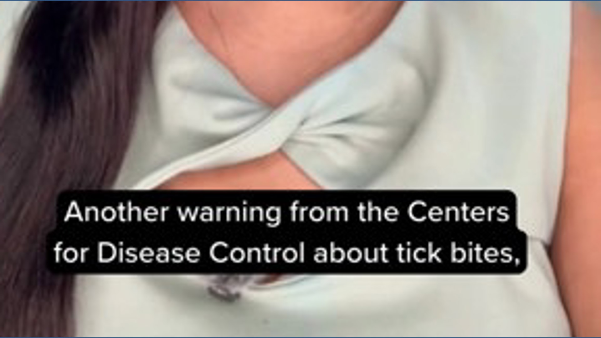 How to protect yourself from tick bites, as CDC again warns about a ...
