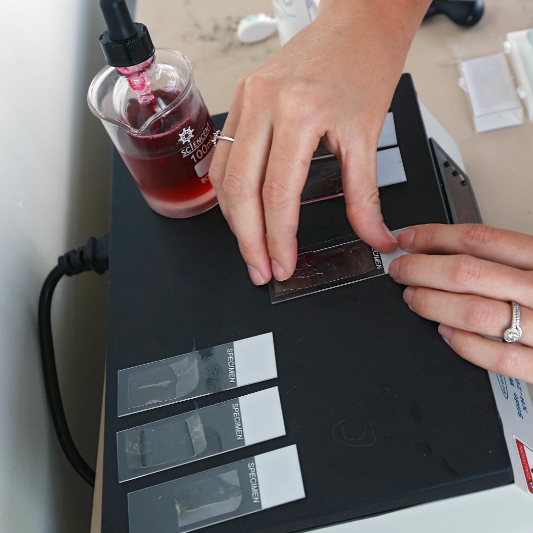 Richmond hospital certified as National Allergy Bureau pollen station ...