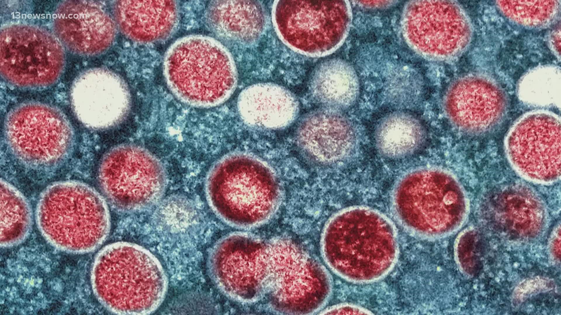 The Virginia Department of Health reported Thursday that a person who had been diagnosed with mpox has died, making it the first reported death in the state.