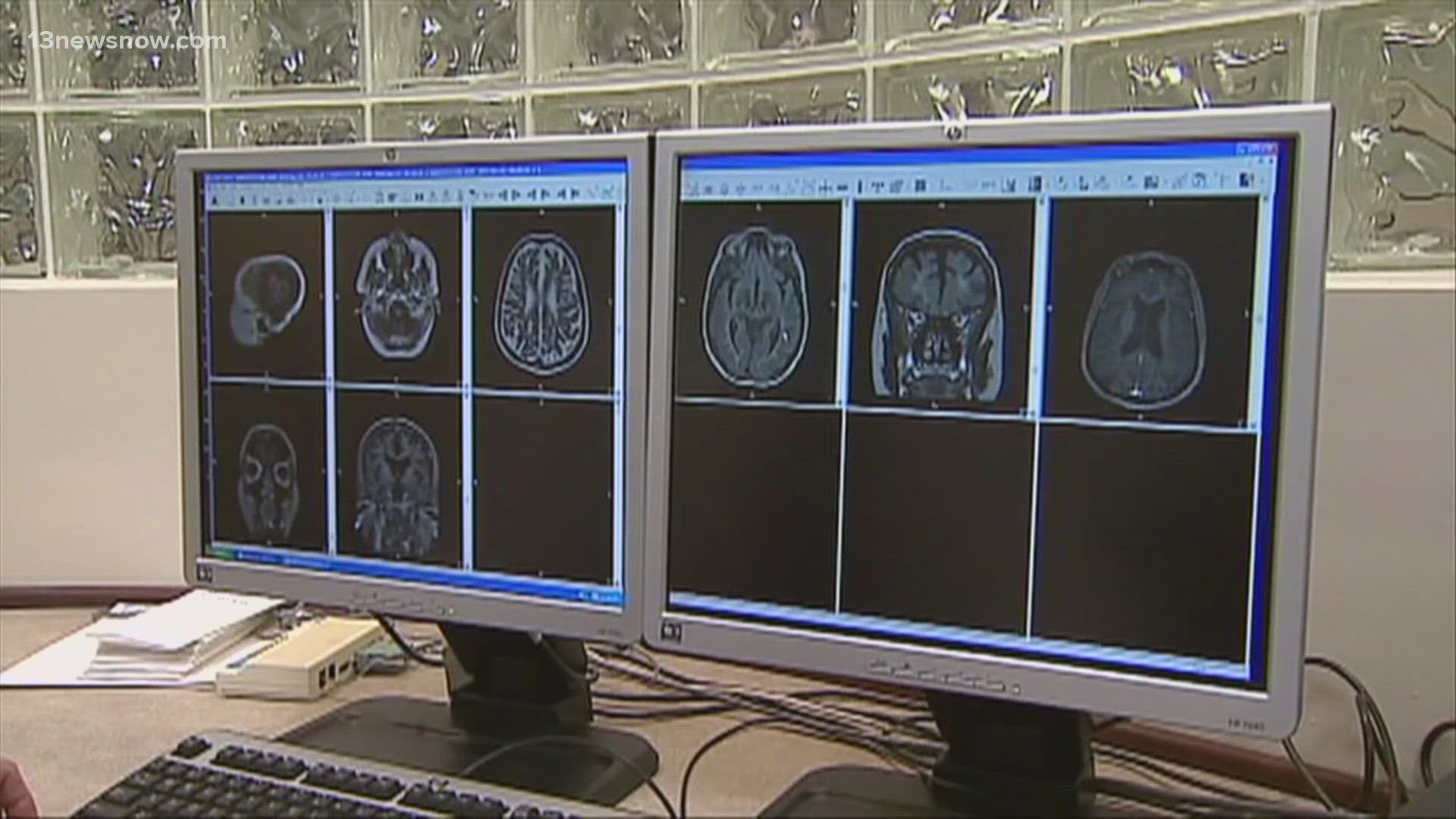 If you think strokes only affect older adults, think again.